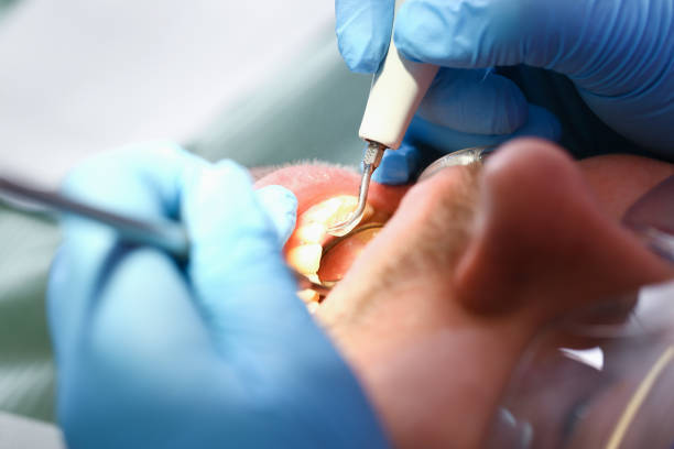 Best Urgent Dental Care for Toothaches in Towson, MD