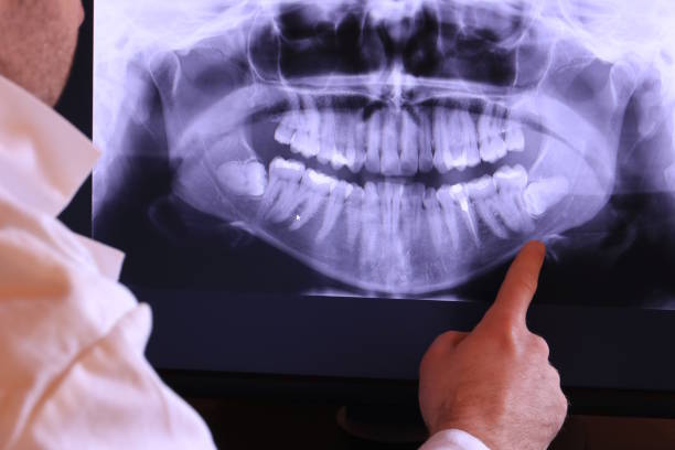 Best Walk-In Emergency Dental Services in Towson, MD