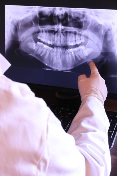 Best Emergency Treatment for Oral Infections in Towson, MD